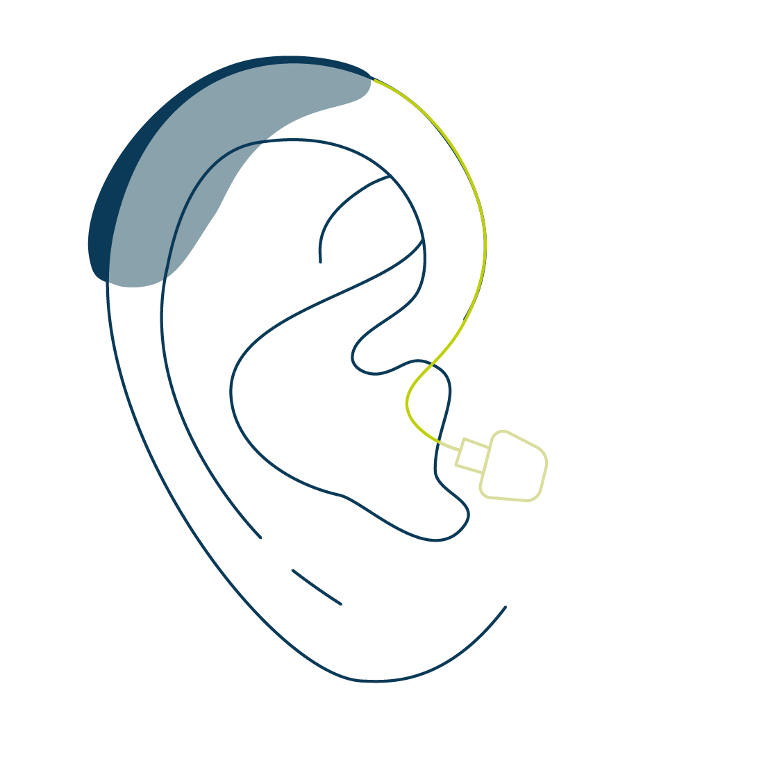 Tekening van oor met toestel voor erop