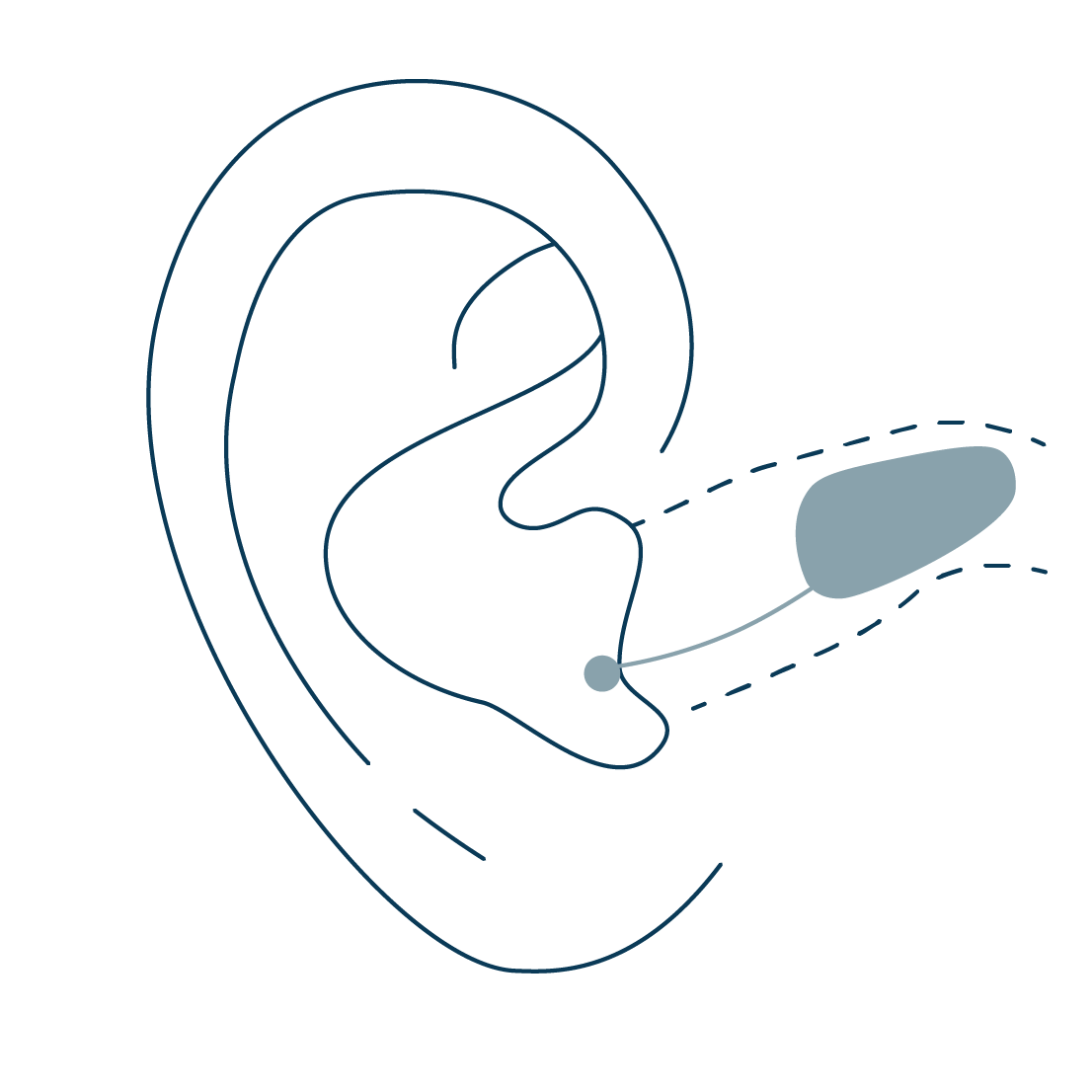 vector van toestel vooraan oor